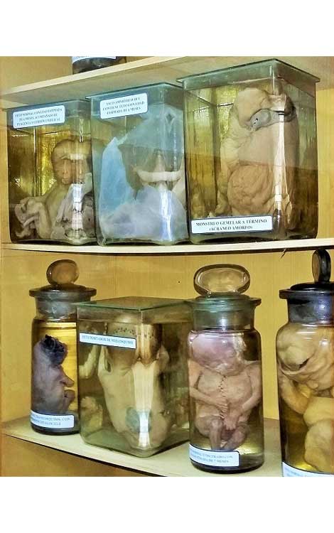 muestra de fetos muestra de fetos