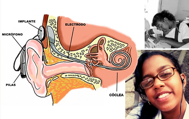 Leslie Machado Hernández, primera villaclareña con implante coclear bilater...