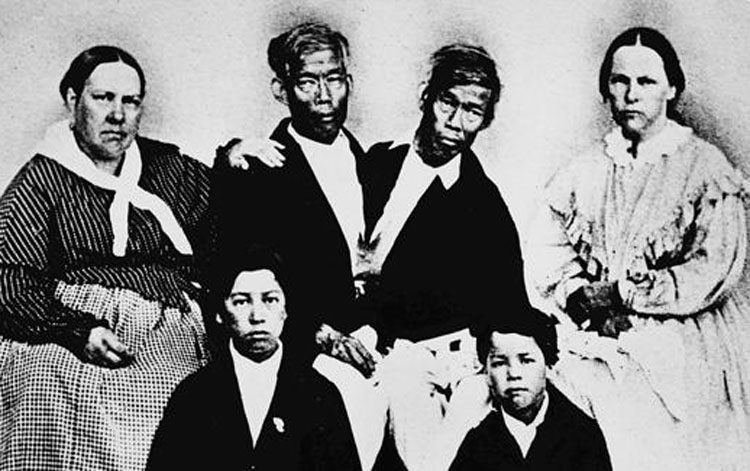 Los hermanos siameses Chang y Eng Bunker