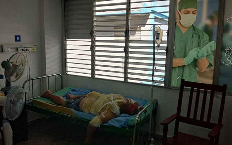 Lesionado en el incendio de la base de supertanqueros de Matanzas, Cuba.