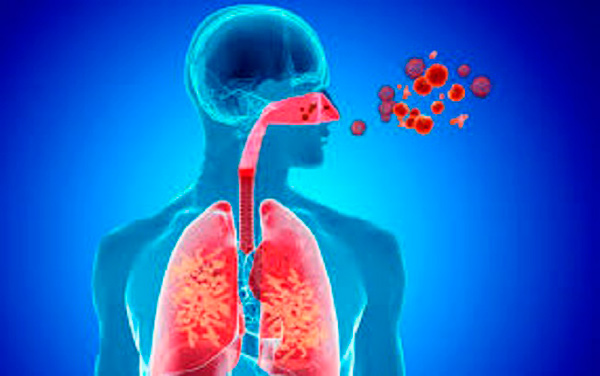 Esquema de las infecciones respiratorias agudas.