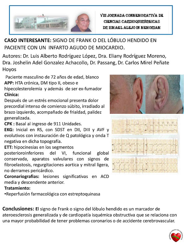 Caso complejo tratado en el Cardiocentro Ernesto Che Guevara, de Villa Clara. Caso complejo tratado en el Cardiocentro Ernesto Che Guevara, de Villa Clara.