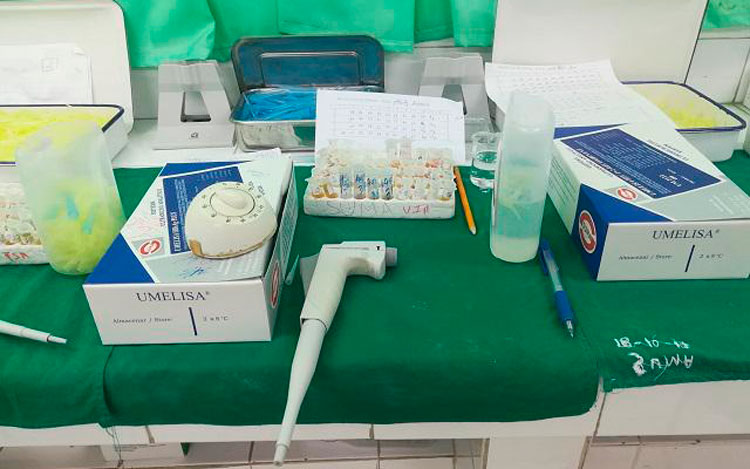  La tecnología del Sistema Ultramicroanalítico permite detectar varias enfermedades de forma temprana, entre las cuales figura la COVID-19. Foto: David Despaigne Brito 