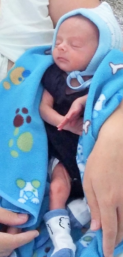 Niño Jean Michel Bosch Zamora recuperándose días después de la intervención quirúrgica.