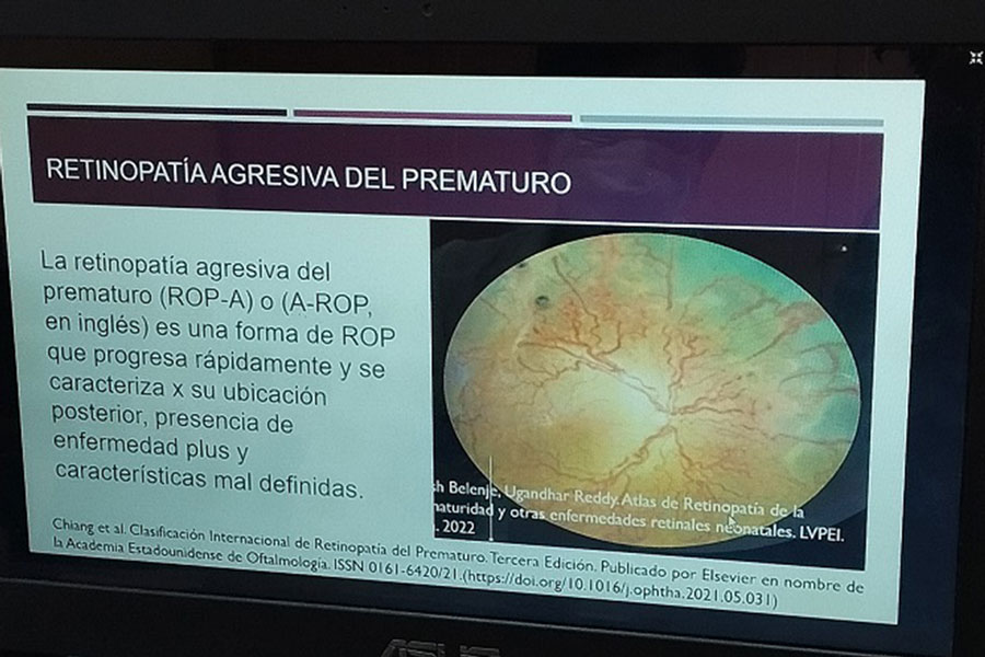 Manifestación agresiva de la retinopatía de la prematuridad.